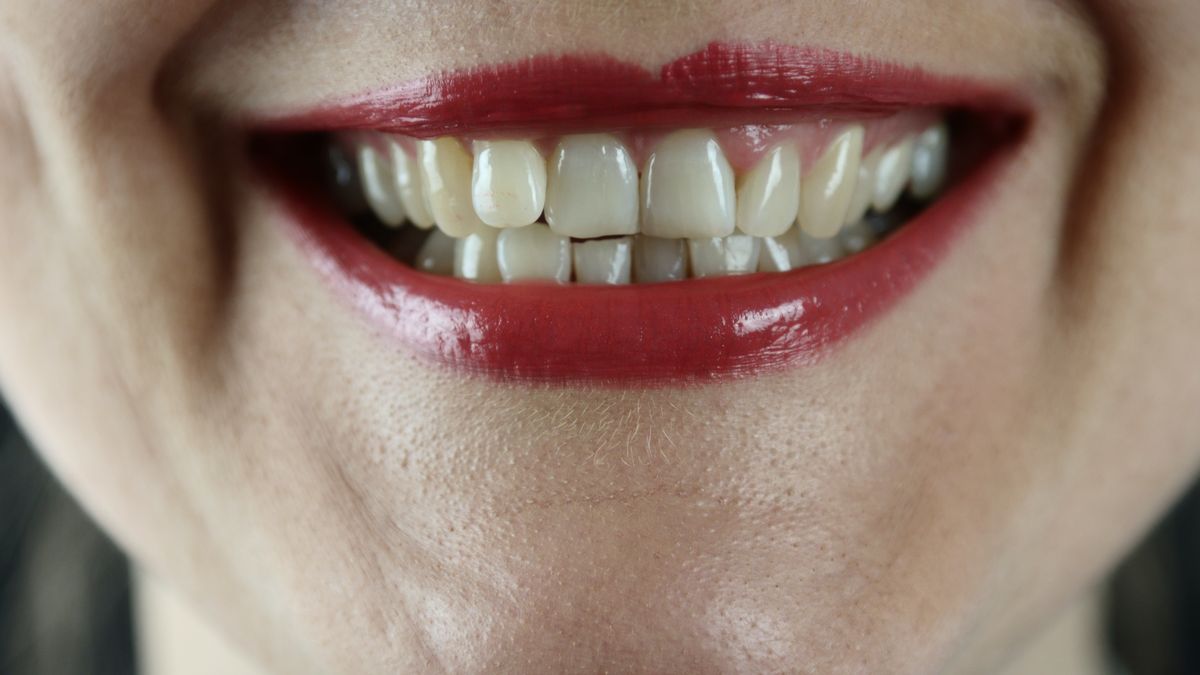 El motivo por el que los dientes se ponen amarillos, según los especialistas