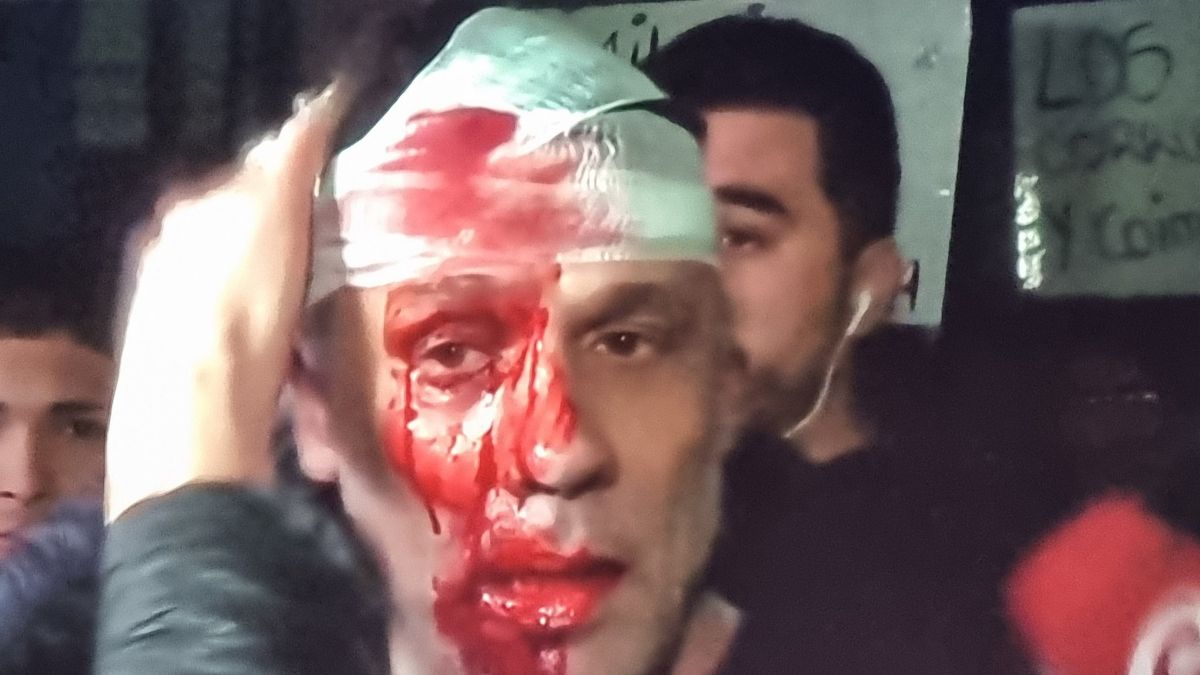 un periodista fue gravemente herido por un botellazo