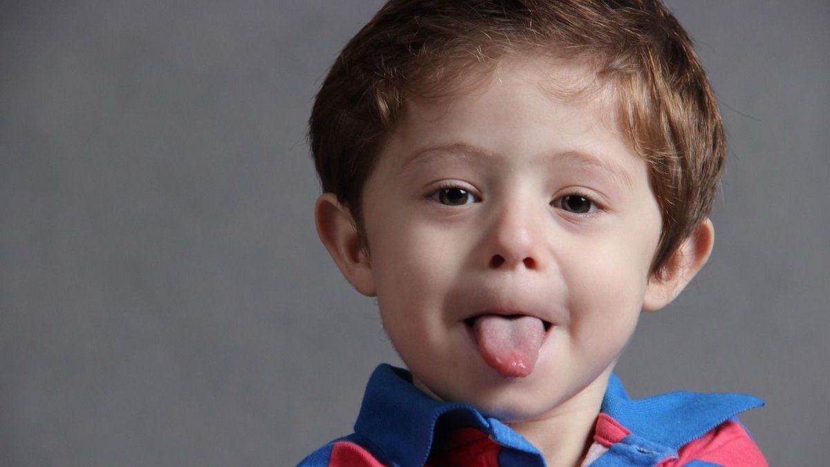 diagnósticos con solo sacar la lengua