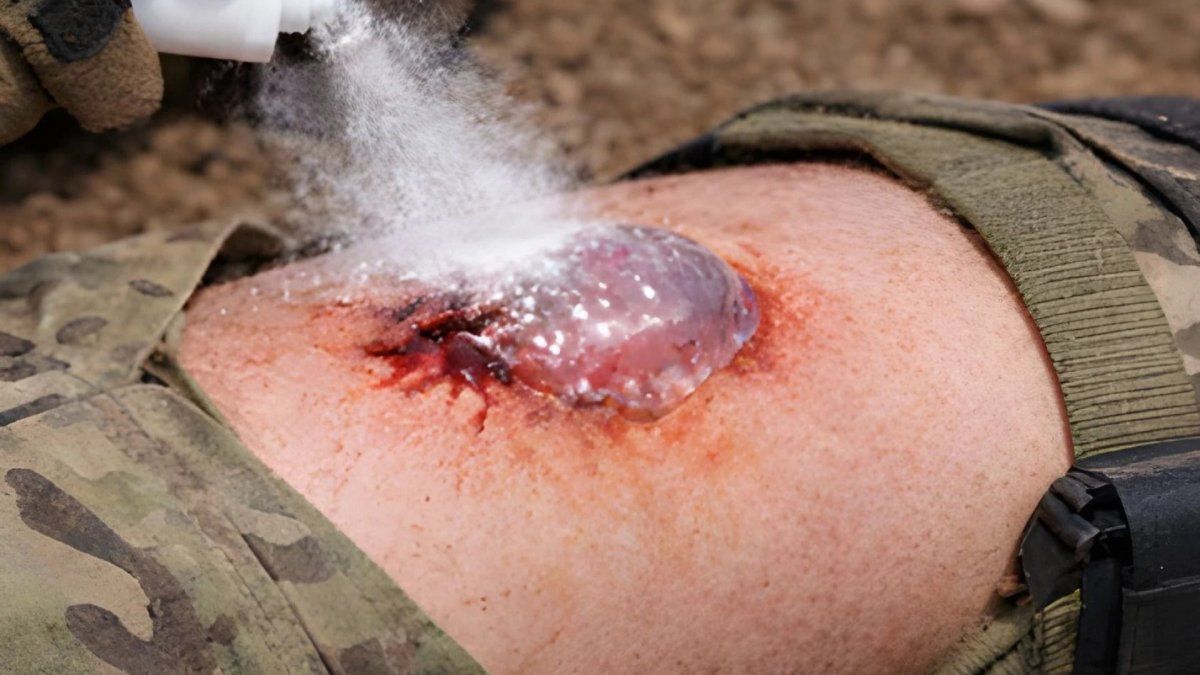 un spray que detiene hemorragias en segundos